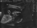 19 Weeks - Baby Benton waving to us!