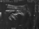 19 Weeks - Baby Benton\'s cute face