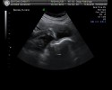 28 Weeks - Baby Benton with her foot in her face!